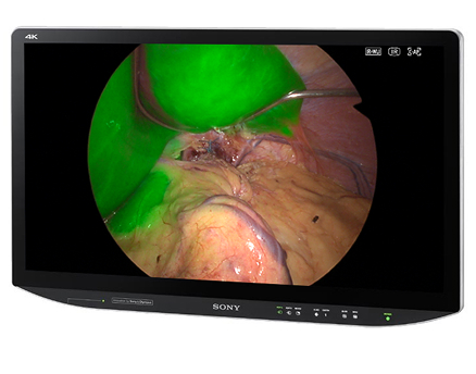 3D 4K Medical LCD Monitor