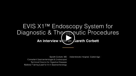 EVIS X1™ Endoscopy System for Diagnostic and Therapeutic Procedures - Play Video